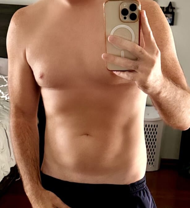 Michael L., after treatment