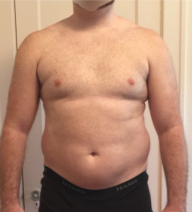 Michael L., before treatment